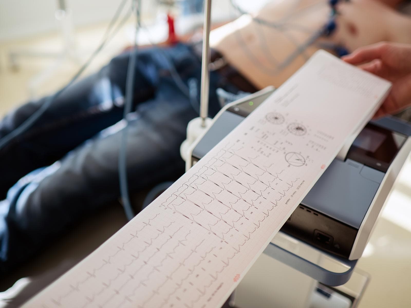 An electrocardiogram being recorded, the trace emerging from the machine while the patient lies down with the electrodes attached
